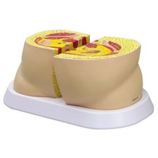 Obesity Body Fat Shape