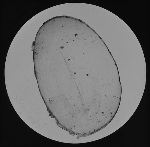 Microscope photo whisker - photo, of