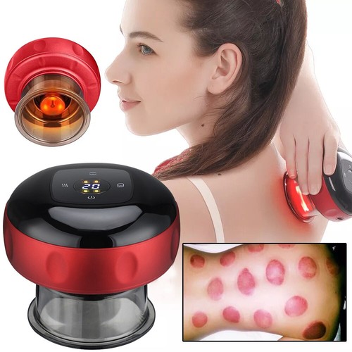 Electric cupping therapy smart - cupping,