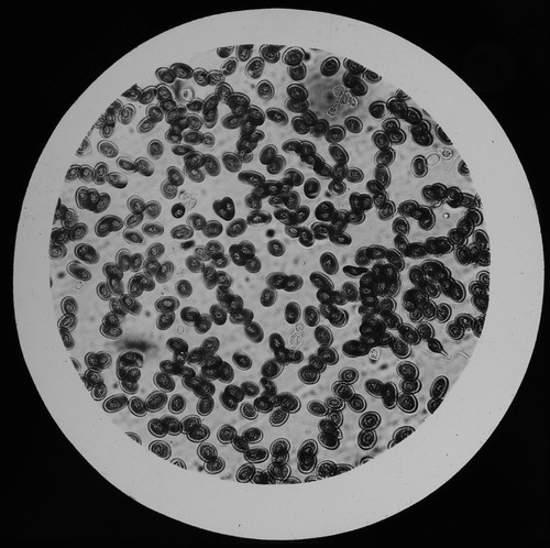 Blood discs frog 1894 old - of,