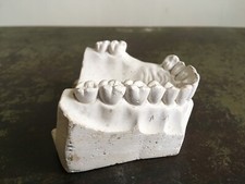 Vintage (Colombia Dentoform) French Human Dentures Model Brocante Salvage France