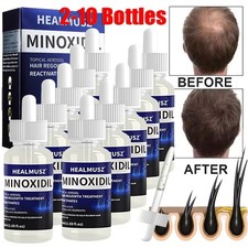 Minoxidil topical solution - 5%,