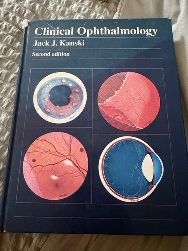 Kanski clinical ophthalmology - clinical,