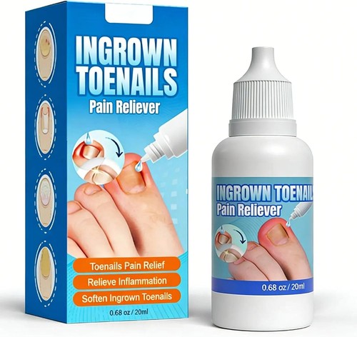 Ingrown toenail treatment - ingrown,