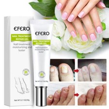 Herbal Fungal Nail Treatment