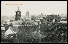 Bird’s-Eye View of Eye