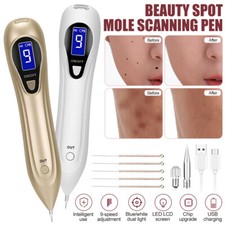 LCD Laser Plasma Skin Tag
