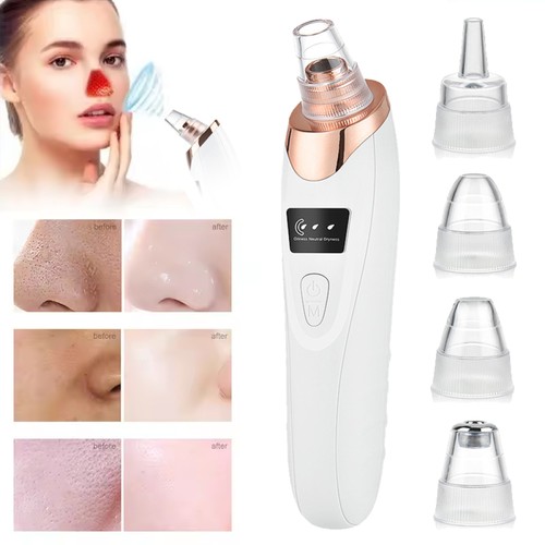 Electric blackhead remover - electric,