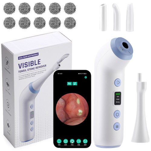 Visible tonsil stone removal - visible,