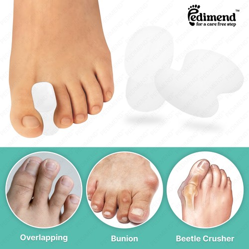 Gel toe separators - toe,