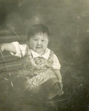 1935 girl with down syndrome odd weird antique vtg photo