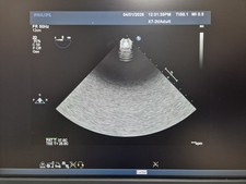 PHILIPS X7-2T TEE ULTRASOUND
