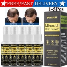 Minoxidil 5% Spray Men Hair Regrowth Treatment Solution 5 Month Supply 60ml