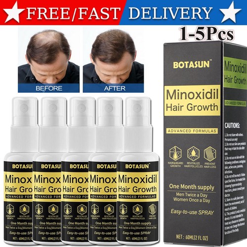 Minoxidil spray hair loss - 5%,