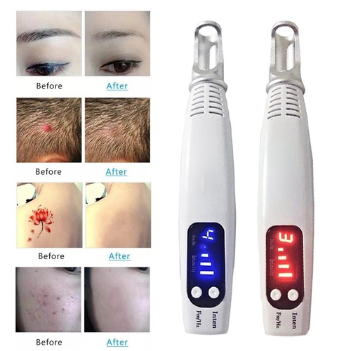 Picosecond laser pen tattoo - picosecond,