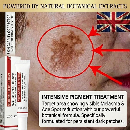 Powerful spot removing whiten - spot-removing,