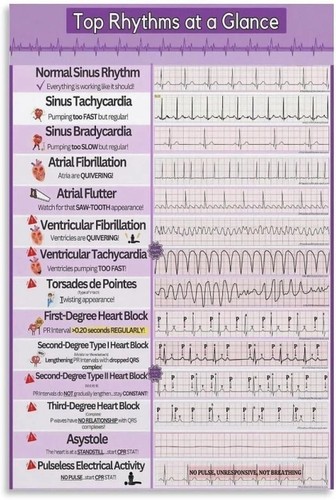 Top heart rhythms glance - heart, at