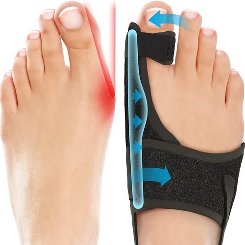 Orthopedic bunion splint - bunion,