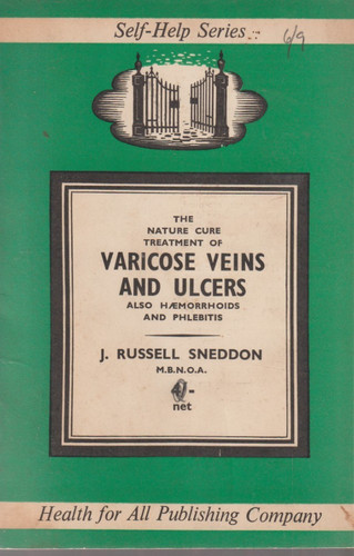 Varicose veins and ulcers - and,