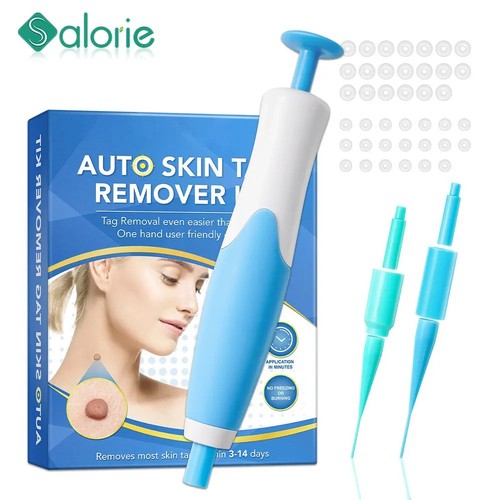 Skin tag remover tool - tag, kit