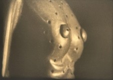 16mm B/W BBC Horizon Documentary Film: 'Acupuncture - A Chinese Puzzle' (1973)