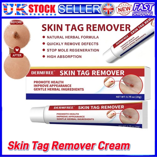 Strong skin tag remover - remover, cream