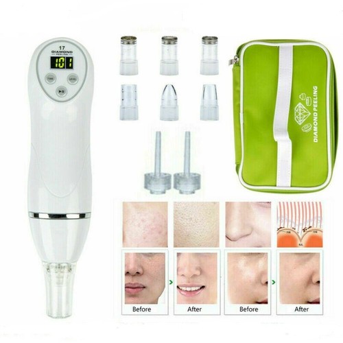 Pro diamond microdermabrasion - pro,
