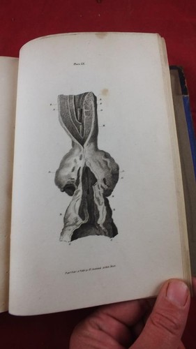 1812 diseases the - diseases,