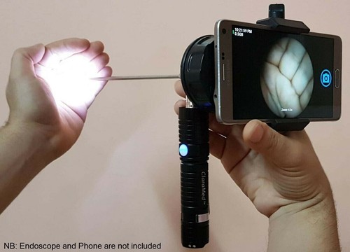 Claramed phone endoscope - phone,
