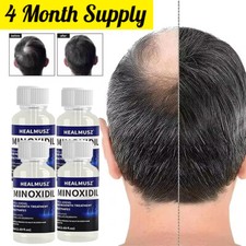 4X Minoxidil 5% Extra Strength for Men Hair Regrowth Treatment Topical Solution