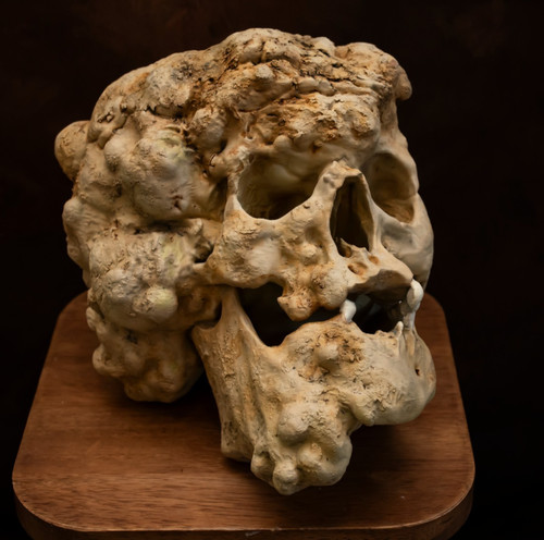 Joseph merrick skull replica - merrick,