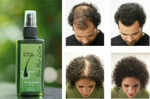 Neo hair lotion - neo, natural