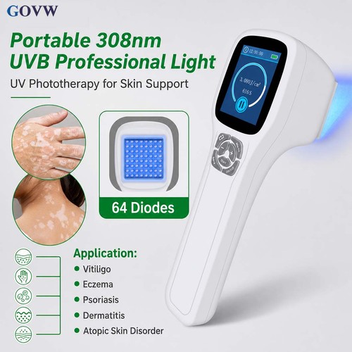 Narrowband uvb 308nm - uvb,