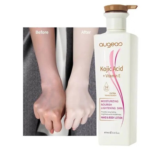 Kojic acid whitening body - kojic,