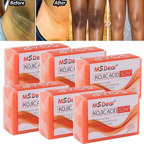 Kojic acid soap dark - acid,