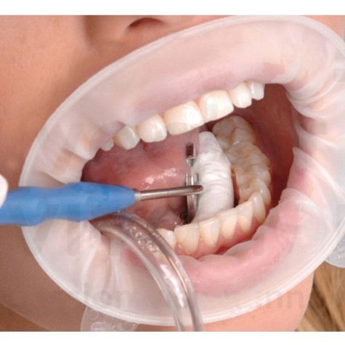 10pcs dental disposable - 10pcs,