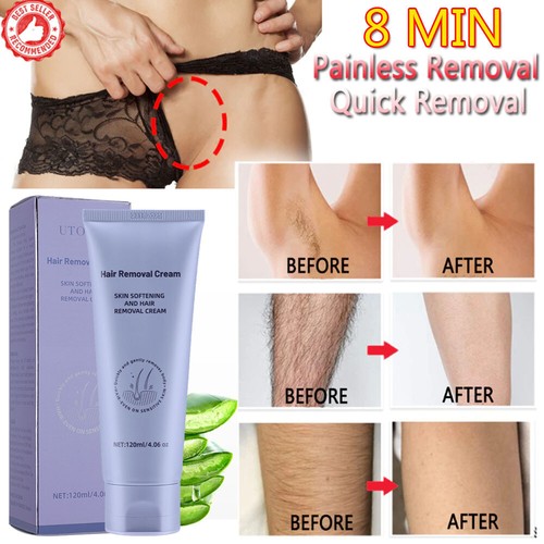 Permanent hair removal - hair,