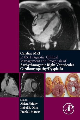 Cardiac mri diagnosis - cardiac,