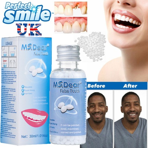 Moldable false teeth - moldable,