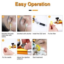 CO2 /C2P/CDT Device for