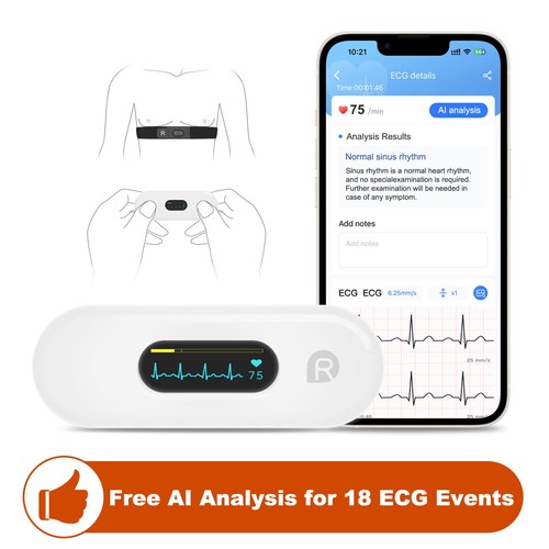 Checkme er2 mobile ecg ekg - mobile,