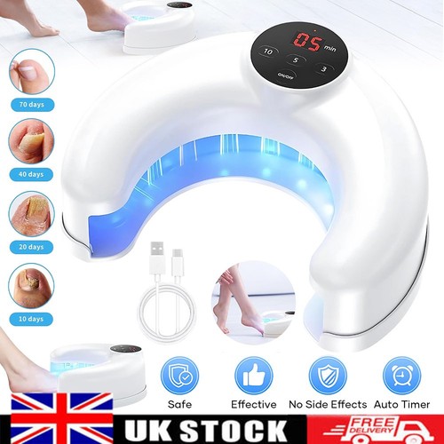 New nail laser - laser, fungus