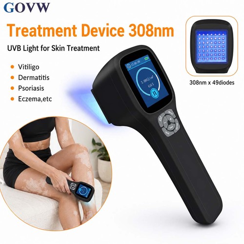 Narrowband uvb 308nm light - uvb,