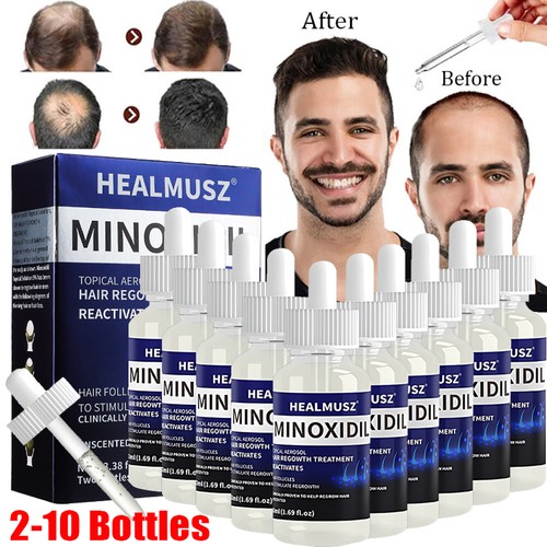 Minoxidil topical solution - 5%,