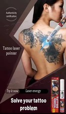 Tattoo laser removal, suitable