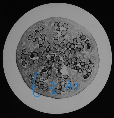 Microscope photo poppy ovary - photo,