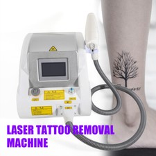 Nd YAG Picosecond Laser Tattoo
