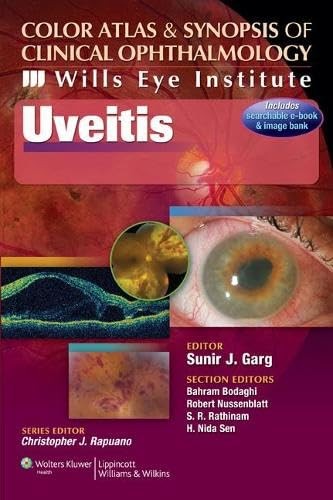 Uveitis color atlas and - color,