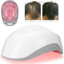 Laser Hair Growth Helmet Anti Hair Loss Regrowth Equipment 180pcs Light Chips