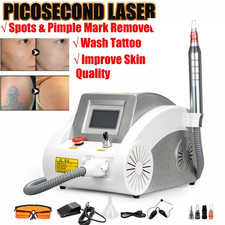 Nd:YAG Laser Tattoo Removal